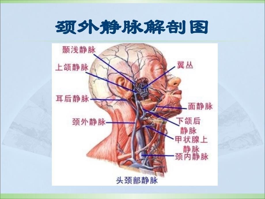 颈外静脉留置针穿刺及护理.ppt_第5页