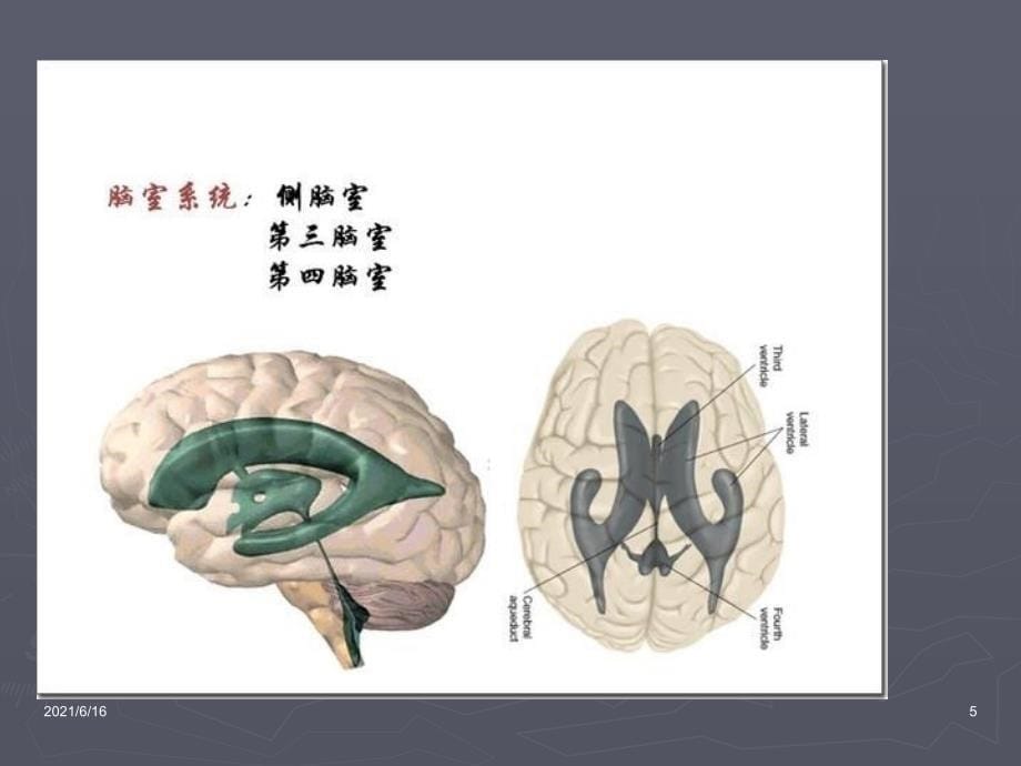 脑积水PPT课件_第5页