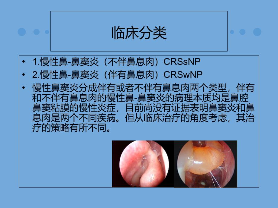 慢性鼻-鼻窦炎诊治及预后_第3页