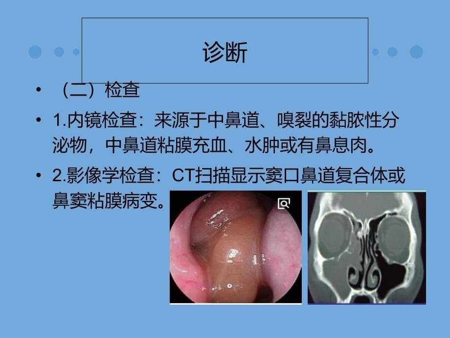 慢性鼻-鼻窦炎诊治及预后_第5页