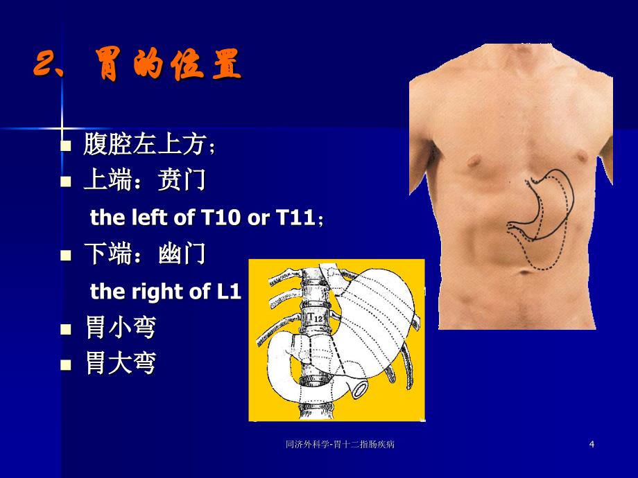 同济外科学-胃十二指肠疾病ppt课件_第4页