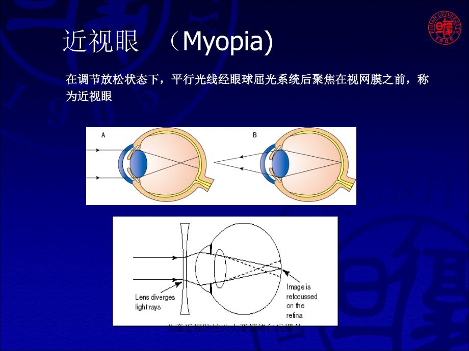 儿童近视防控八大要领褚仁远课件_第4页