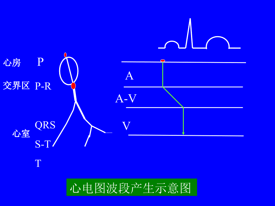 第五节心律失常课件_第3页