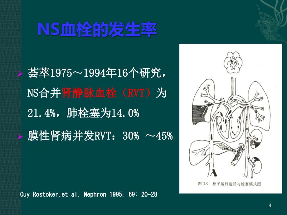 肾病综合征抗凝治疗ppt课件_第4页