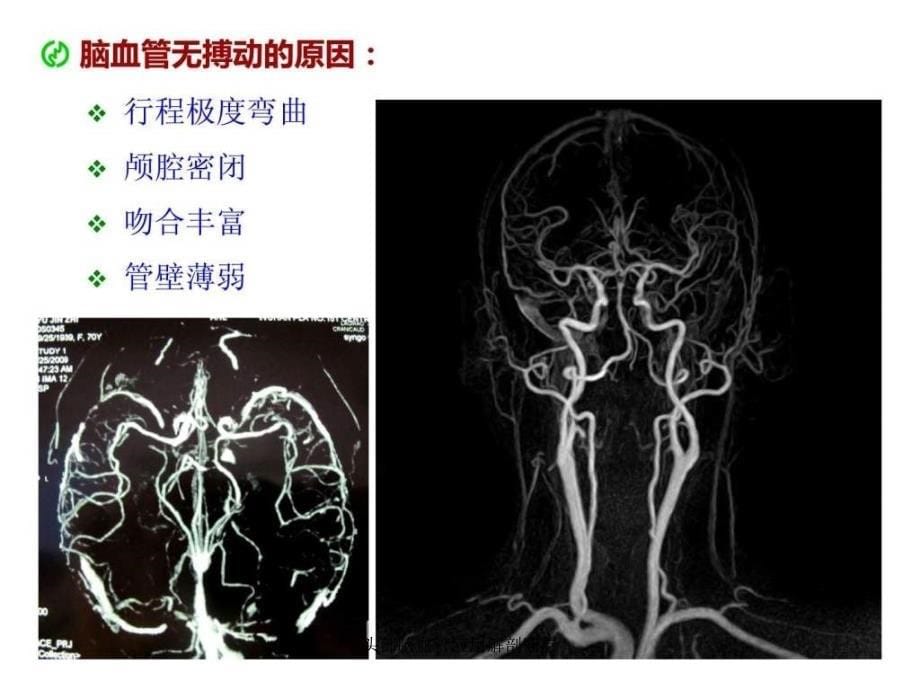 头部脑血管应用解剖断层课件_第5页