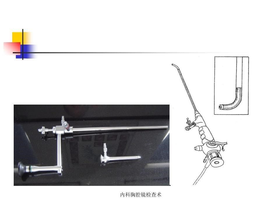 内科胸腔镜检查术_第5页