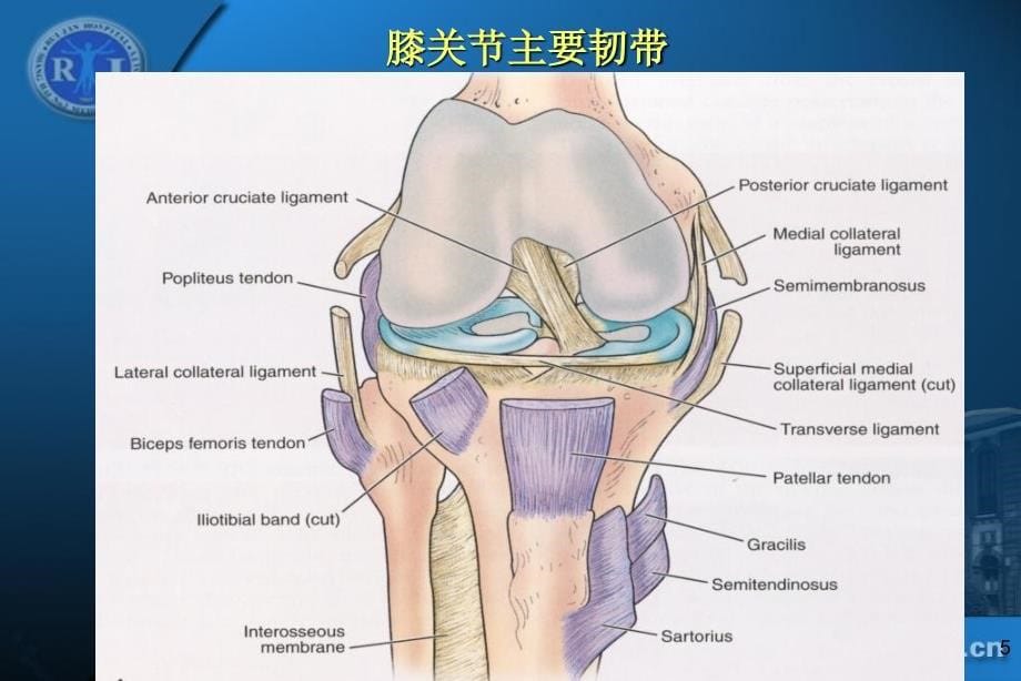 36膝关节韧带损伤的MR诊断丁晓毅dxy_第5页