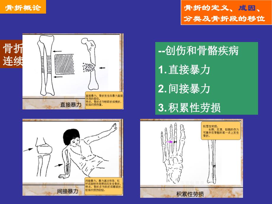 骨折护理常规_第4页