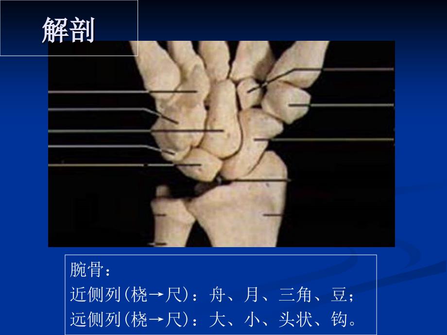 腕关节病变的影像学诊断(1)教学内容_第4页