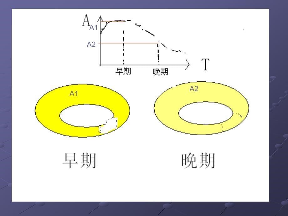 核医学课件：心肌灌注显像_第5页