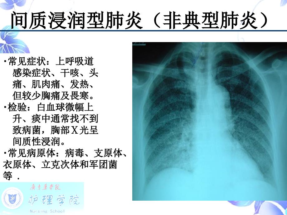 《SARS病人的护理》.ppt_第3页