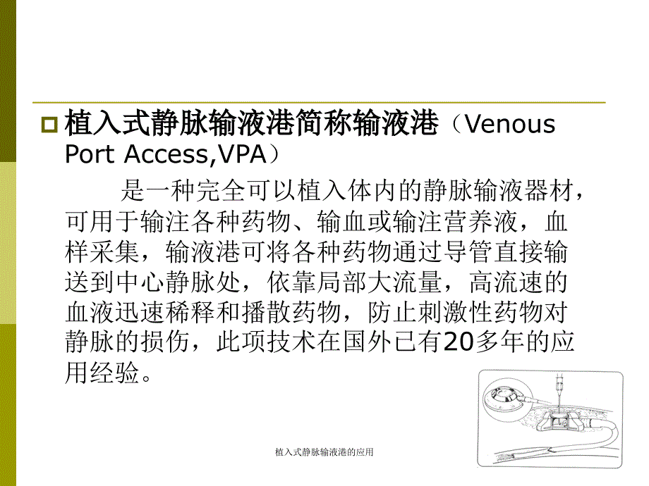 植入式静脉输液港的应用（经典实用）_第3页