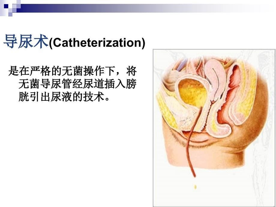 尿失禁、导尿及膀胱冲洗相关理论_第5页