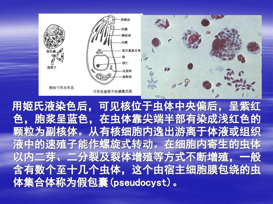 第七节刚地弓形虫_第4页