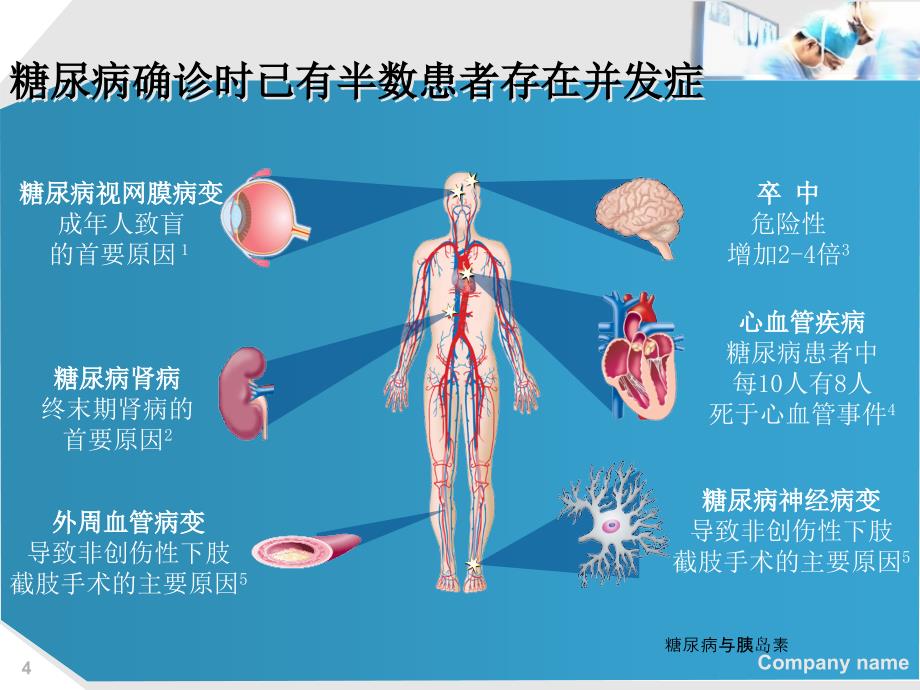 糖尿病与胰岛素课件_第4页