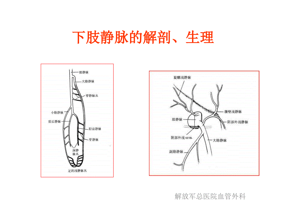 浅谈下肢静脉曲张及其治疗策略课件_第3页