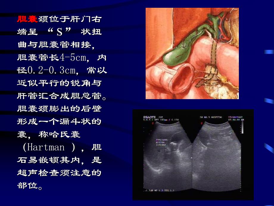 胆囊超声诊断学文档_第4页