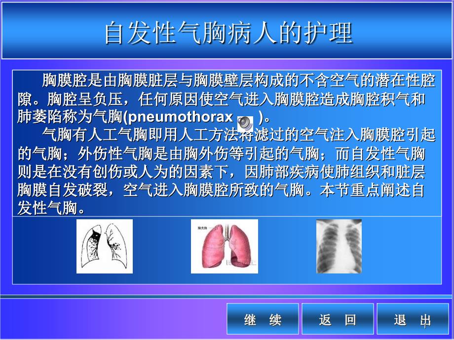 自发性气胸病人的护理PowerPoint 演示文稿_第1页