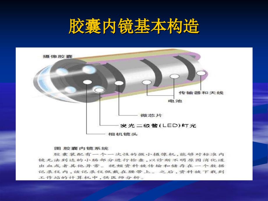 《胶囊内镜在小肠疾》PPT课件_第4页