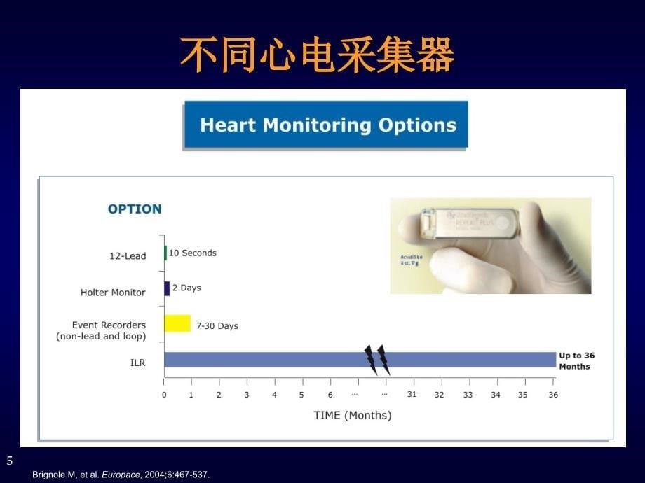 缓慢性心律失常的诊治概况_第5页