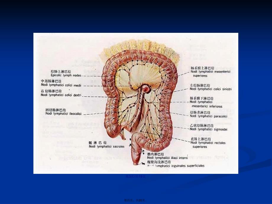 肠系膜淋巴结炎学习教案_第4页