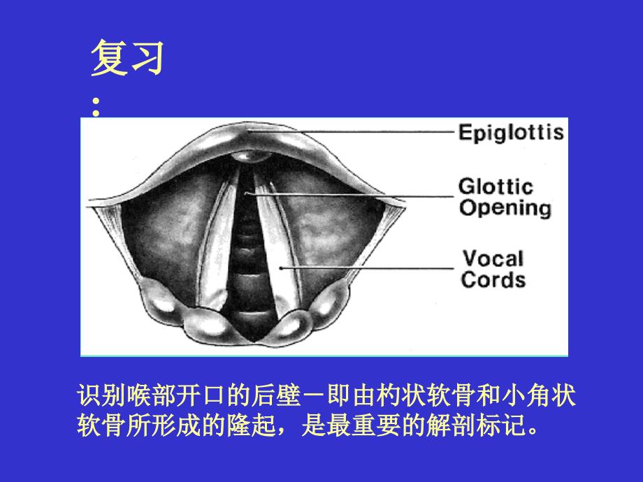 气管插管及困难1课件_第4页