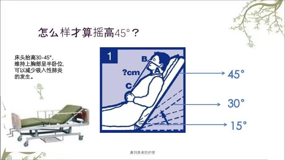 鼻饲患者的护理课件_第5页