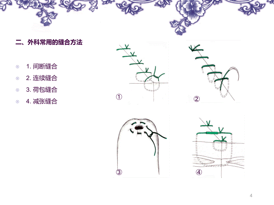 手术缝合线ppt课件_第4页