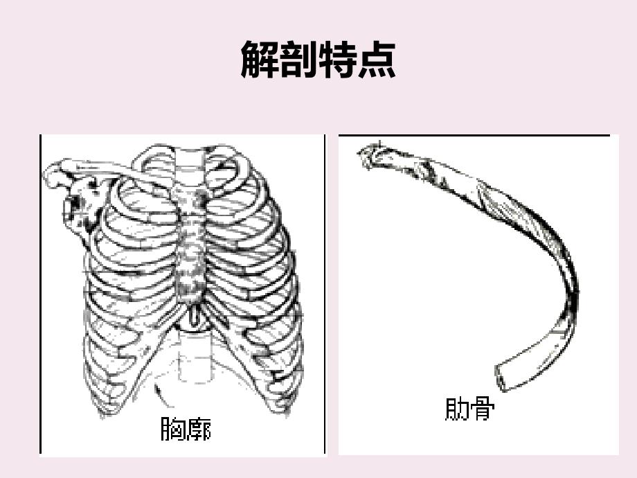 肋骨骨折.ppt_第4页