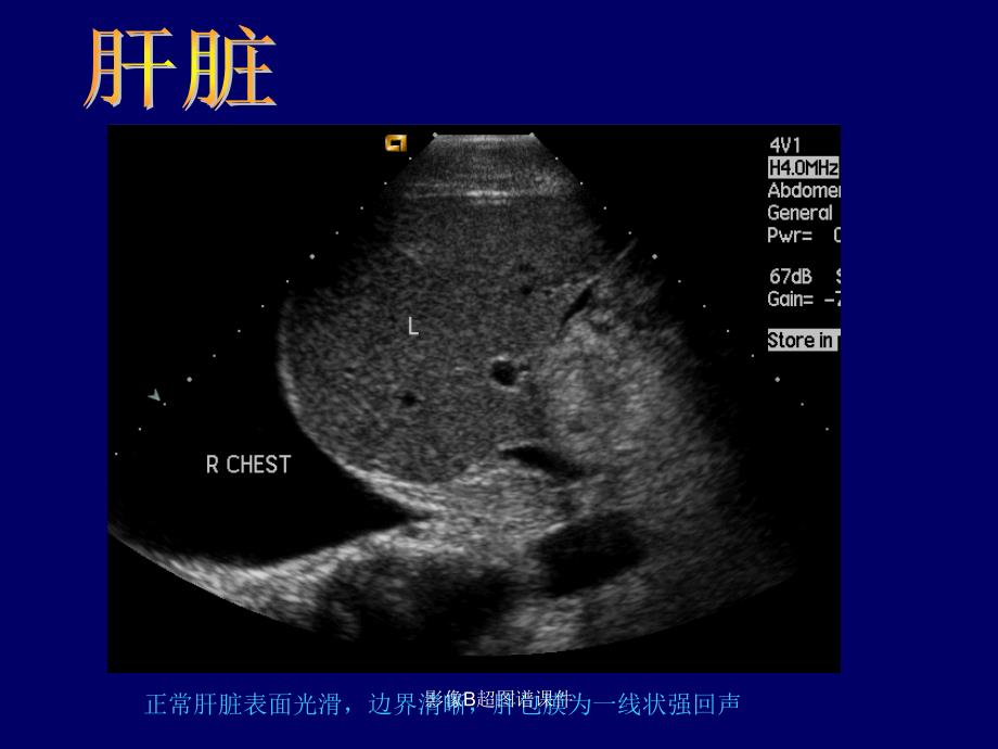 影像B超图谱课件_第4页