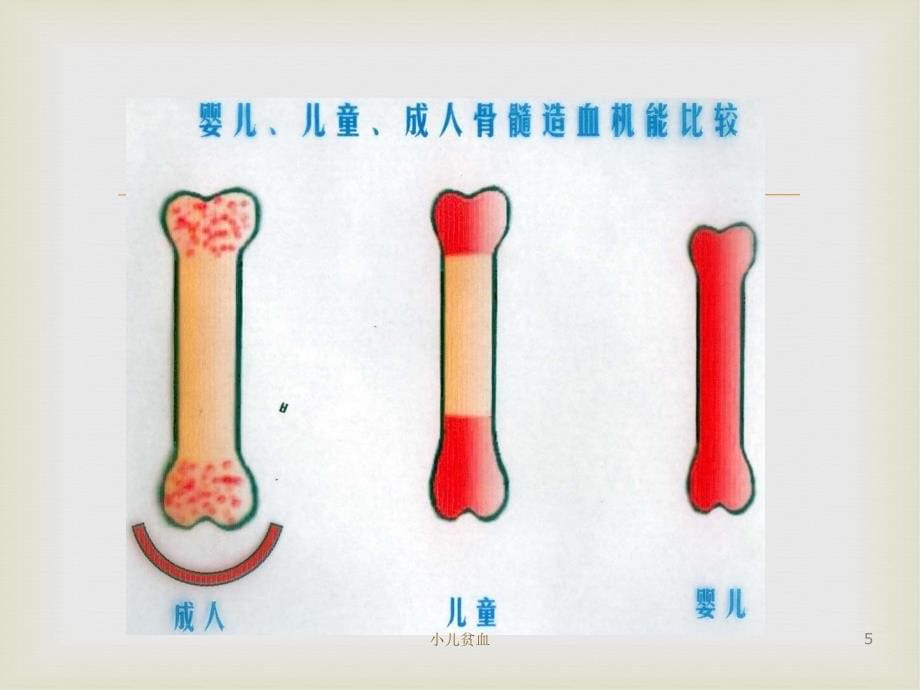 儿科学——小儿贫血_第5页