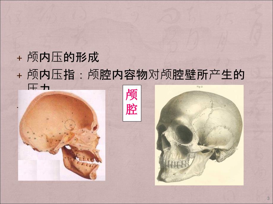 颅内压增高患者的护理ppt课件_第3页