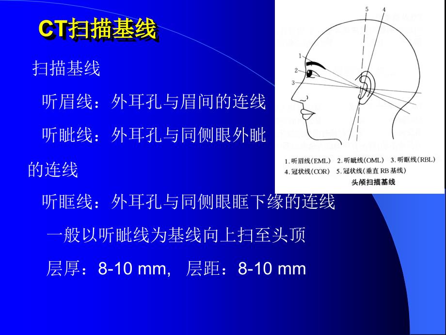 头颅CT扫描技术_第3页