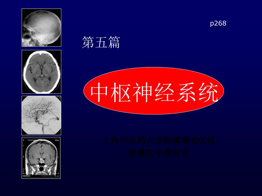 《影像诊断学》教学课件-神经_第1页