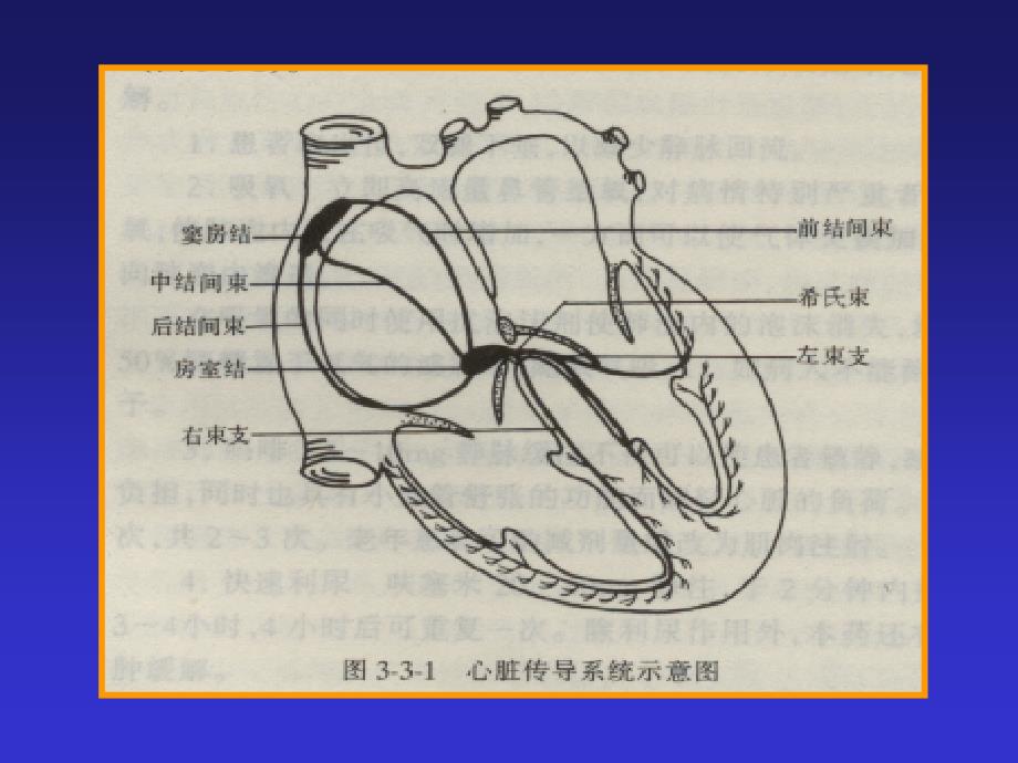 心律失常内科学课件2_第4页