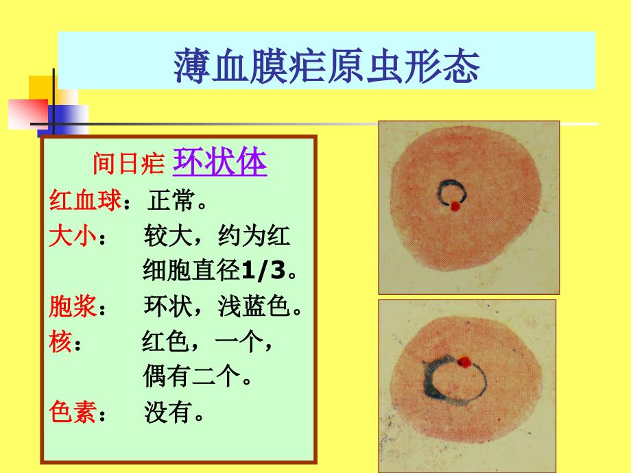 薄血膜疟原虫的形态课件_第3页