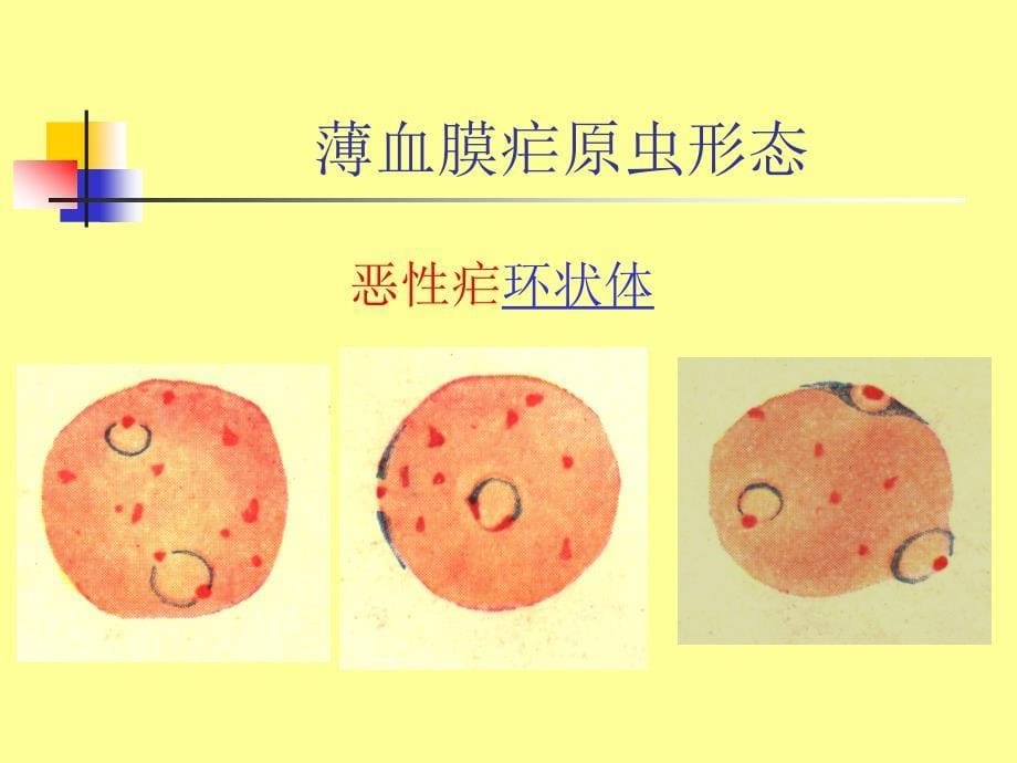 薄血膜疟原虫的形态课件_第5页