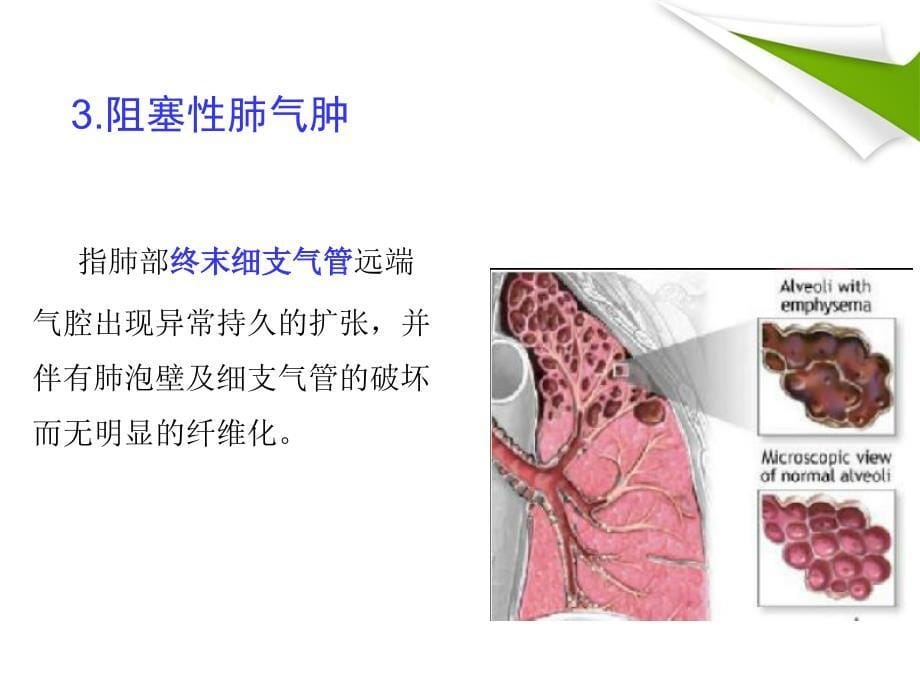 慢性阻塞性肺气肿详解课件_第5页