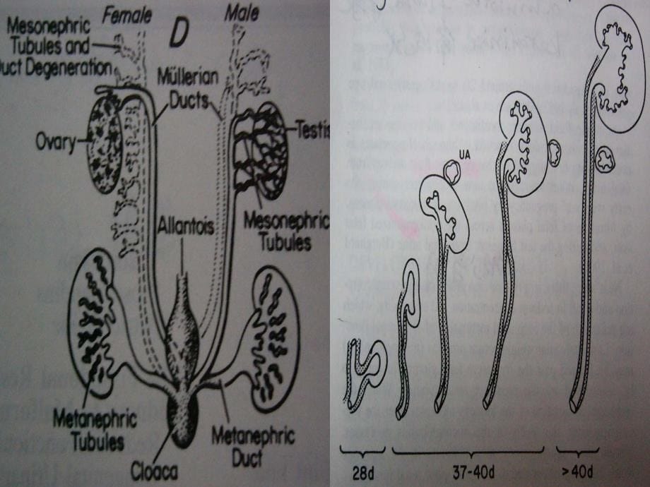 外科学课件：泌尿男生殖系统肿瘤_第5页