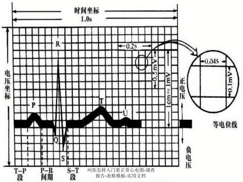 叫你怎样入门看正常心电图-调查报告-表格模板-实用文档课件_第2页