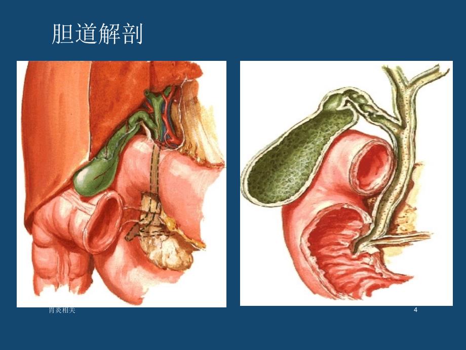 内科学-急性胆囊炎（专业应用）_第4页