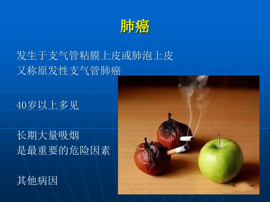 外科学教学资料胸部肿瘤_第3页