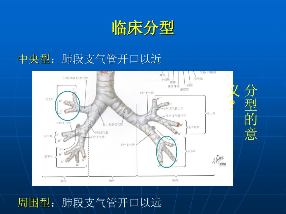 外科学教学资料胸部肿瘤_第4页