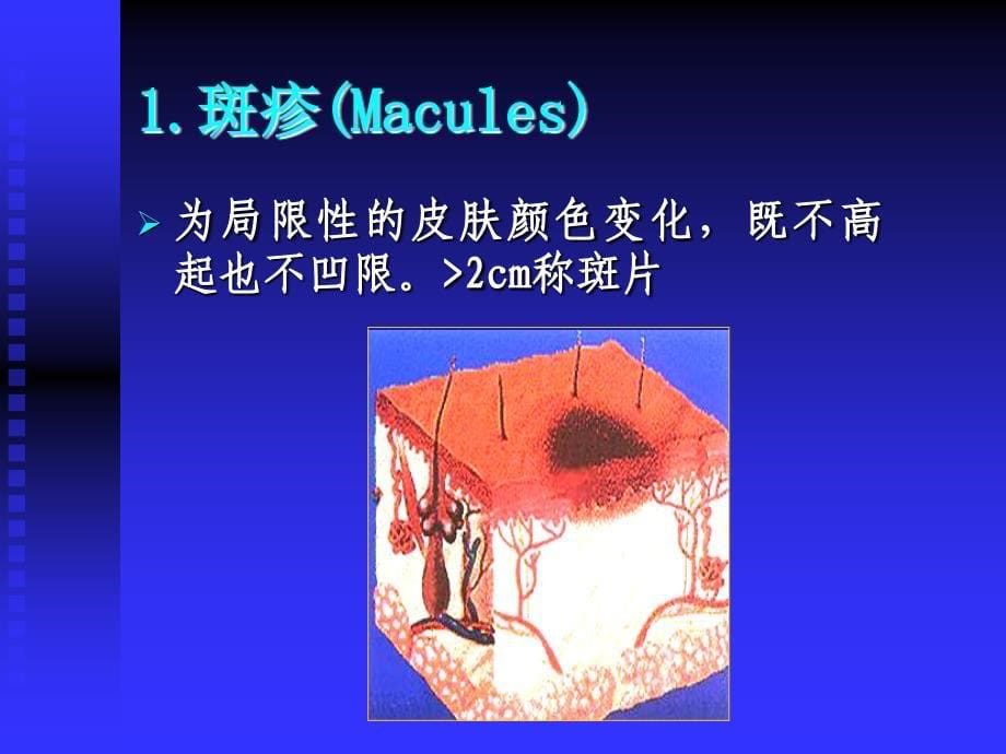 皮肤病的症状课件_第5页