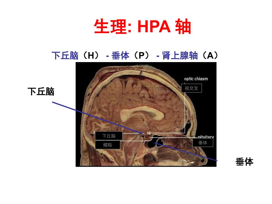 肾上腺皮质激素治疗指南培训资料_第4页