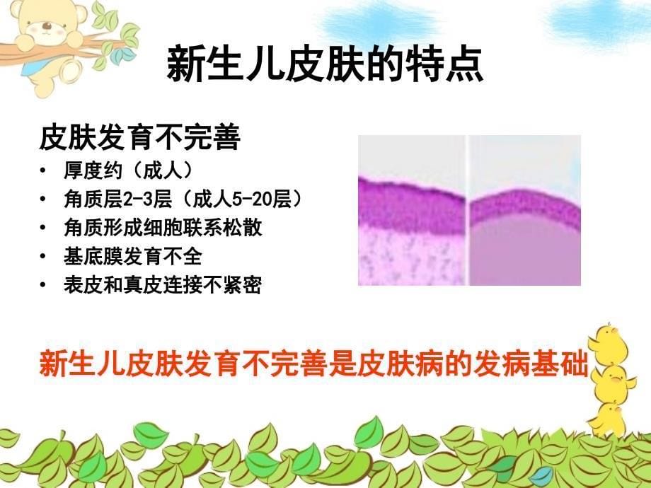 《生儿红斑的护理》PPT课件_第5页