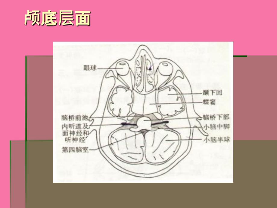 脑头颅CT示意PPT课件_第2页