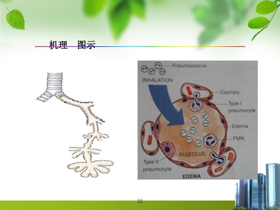 大叶性肺炎ppt课件_第5页