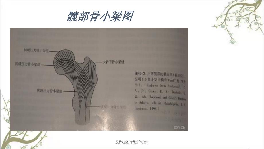 股骨粗隆间骨折的治疗课件_第4页